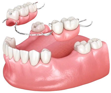 rehabilitacion-oral